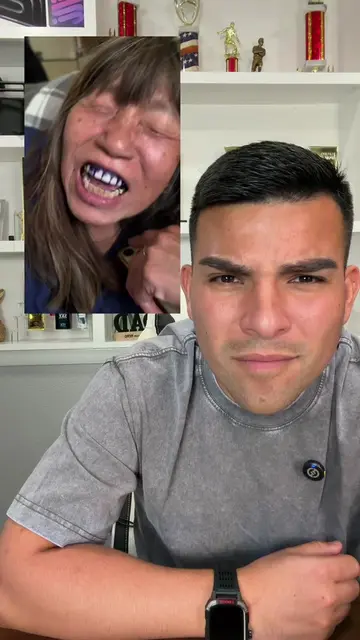 La verdad mis dientes si quedaron blancos ❤️ #dientesblancos #teethwhiteningstri