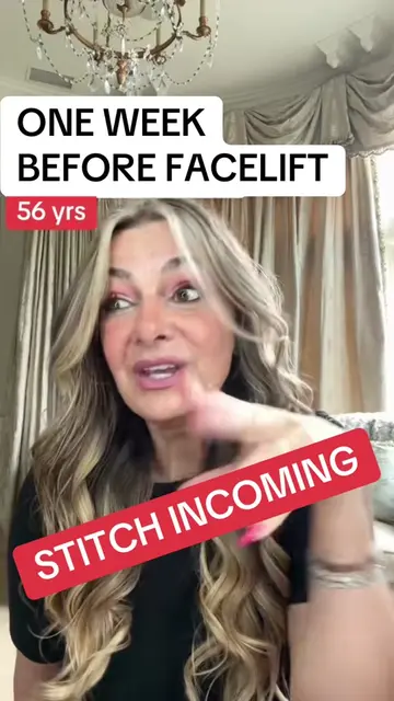 Natural facelift outcome achieved #faceliftjourney #plasticsurgery #necklift #fa