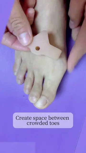 🦶 Crowded or overlapping toes can create friction, pressure and discomfort insi