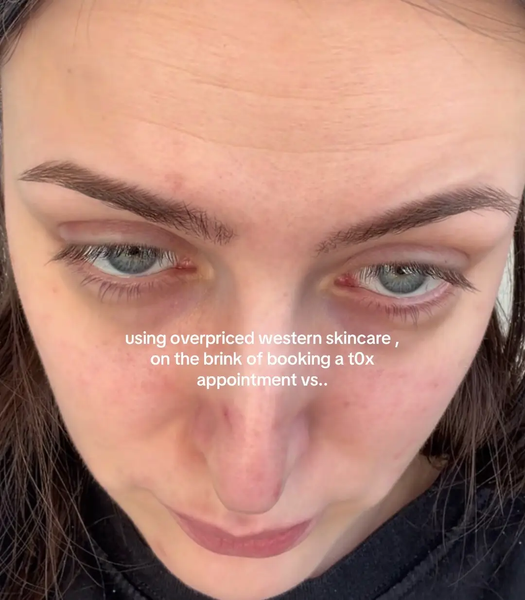 I was on the brink of giving up with my skin couple years ago but I’m so glad I 