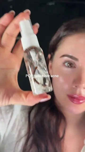 Trying this Clove & Rice Water Spray for my acne-prone skin #acne #clovewater #r