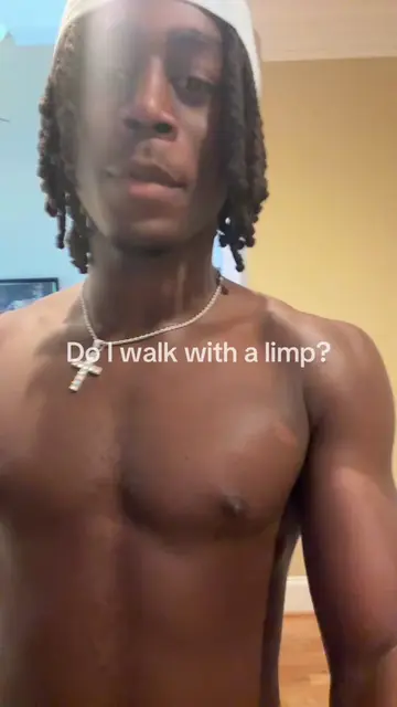 #walk #limp #fyp 