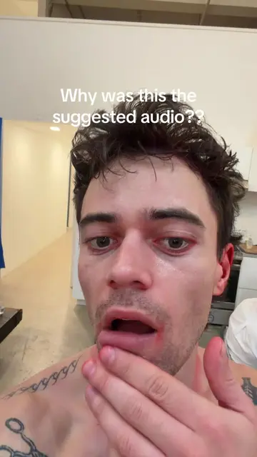 Bro what??