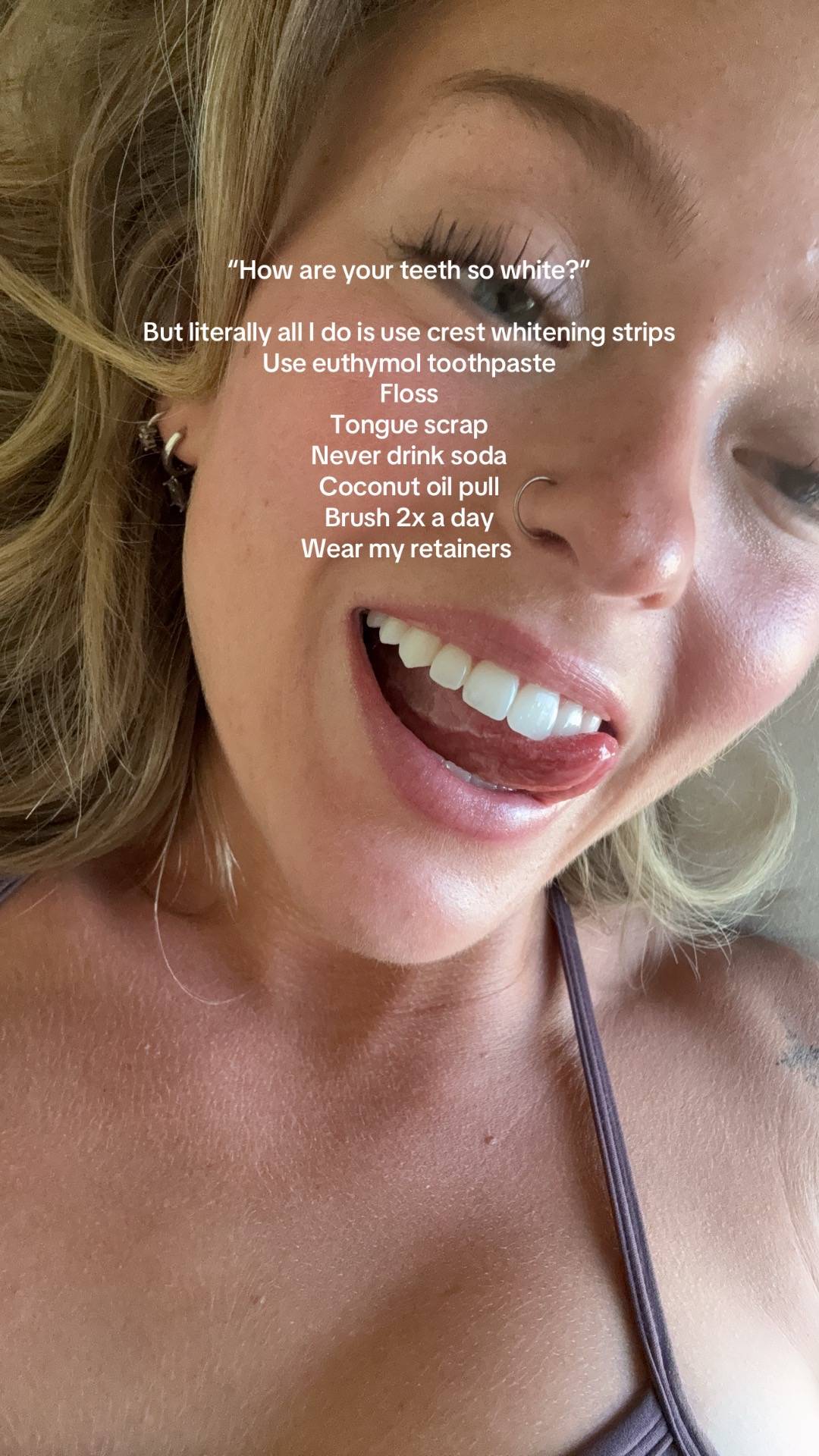 White teeth for the win