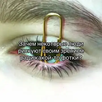 Для чего, фотка не стоит вашего глаза #щп #щитпост #eye #photo #fyp 
