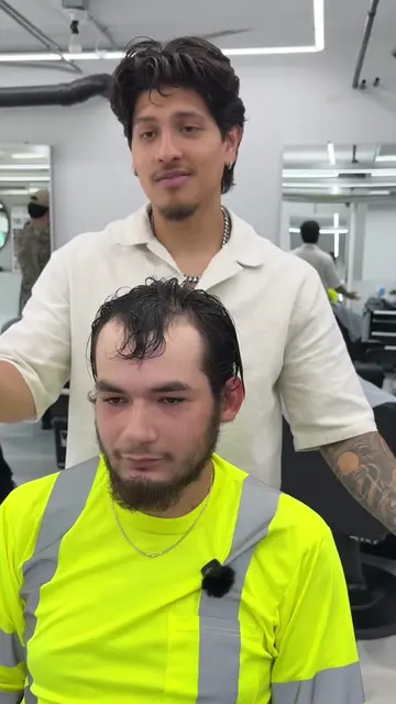 My client came in frustrated with his receding hairline. Instead of trying to hi