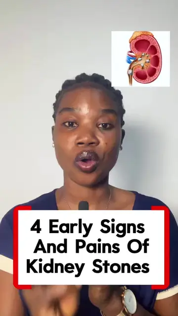 Signs of kidney stones #creatorsearchinsights #early #kidneystone 