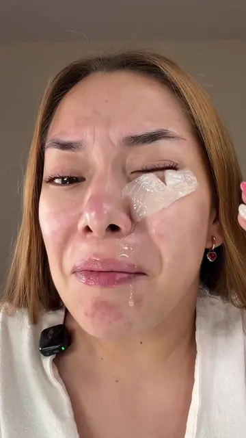 Parches de ojos con microagujas 🫪💉 #microagujas #microneedling #reedleshot #ey