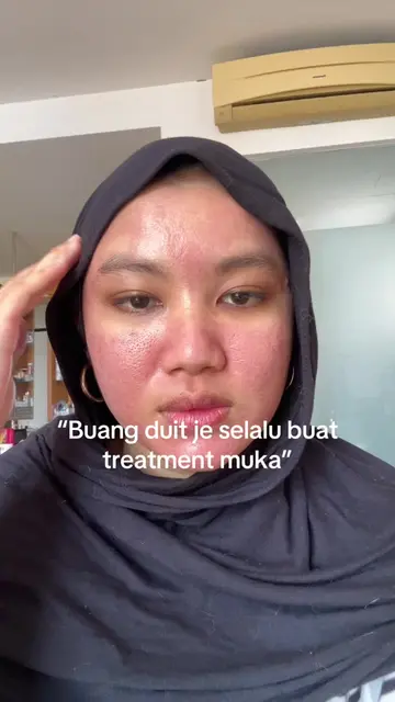 Anyway, 4th TCA + CO2 and 2nd Subsicion later💅🏻I’m gonna be pretty af! (Not th