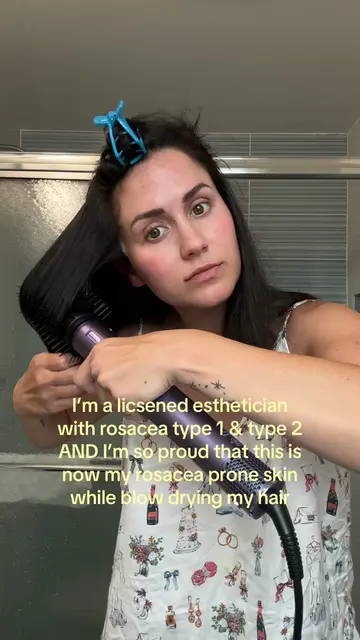 If you have rosacea let me be your esti besti!! I talk about ways I’ve healed my
