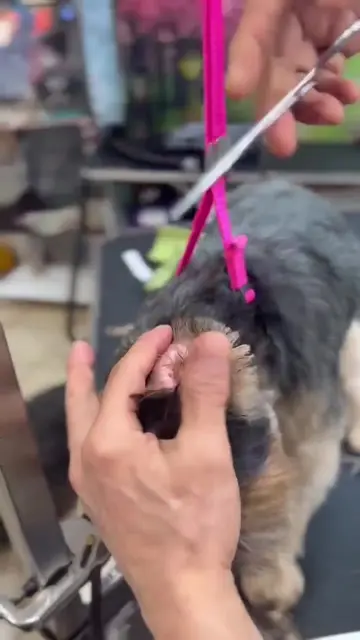 Ear plucking helps prevent infections and keeps ears healthy. *Performed by a pr