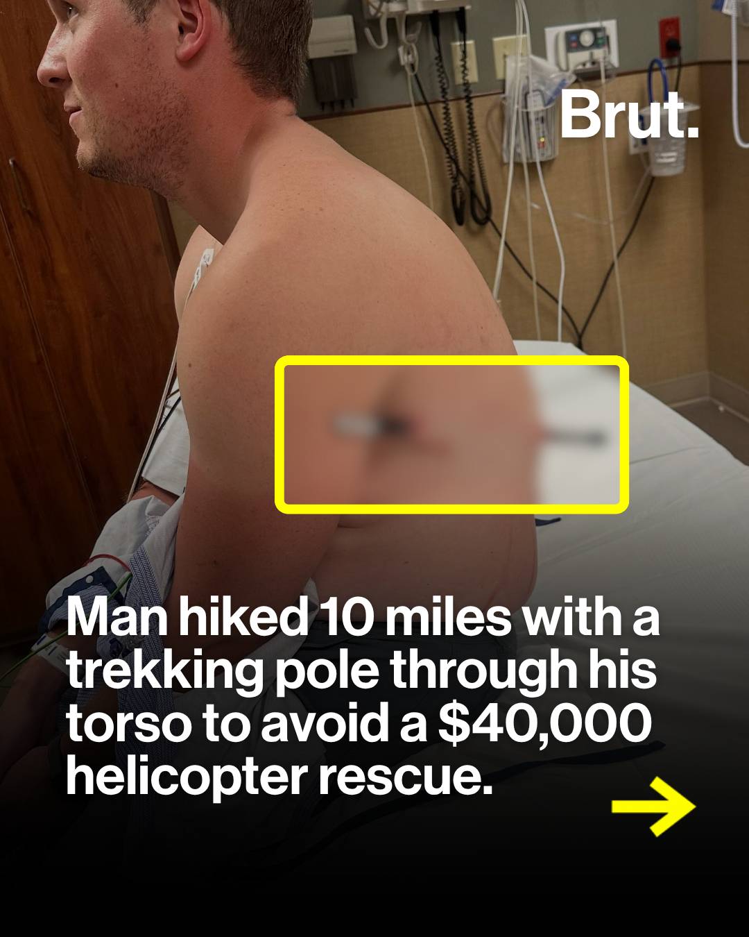 A Montana hiker walked 10 miles to safety with a trekking pole lodged through hi
