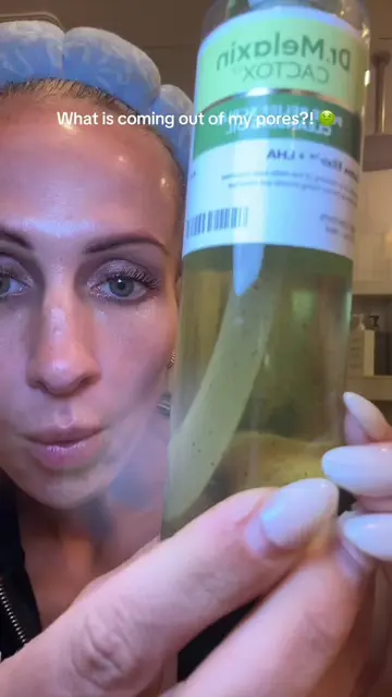 I was actually disgusted by this.. 🤮 #DrMelaxin #PoreCare #DoubleCleansing #Bla