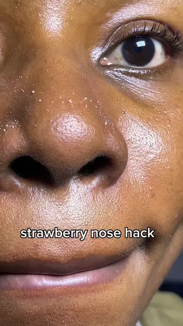 How I went from bumpy texture and stubborn blackheads to smooth, clear skin.  ⁠#