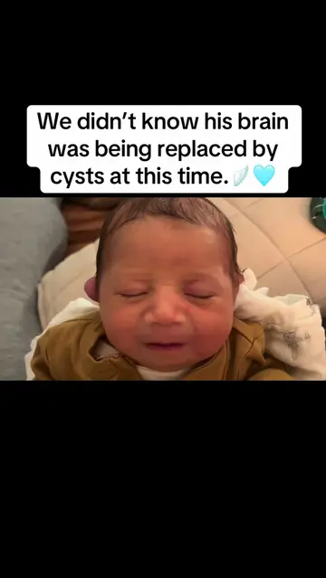 Multicystic encephalomalacia is a reality I wouldn’t wish on anyone. It allows a