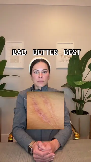 Make the right choice! #derrmtok #dermatologist 