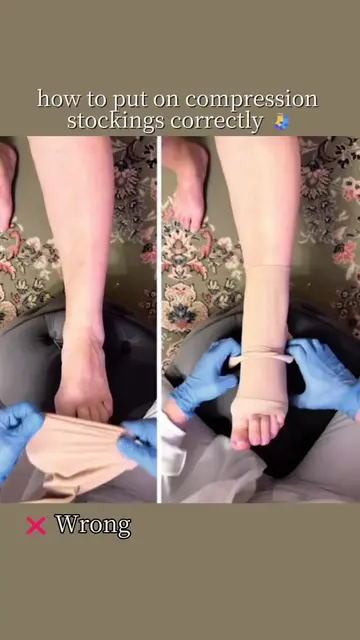 Compression stockings: wrong vs. right 🧦 Rolling or bunching the stocking can c