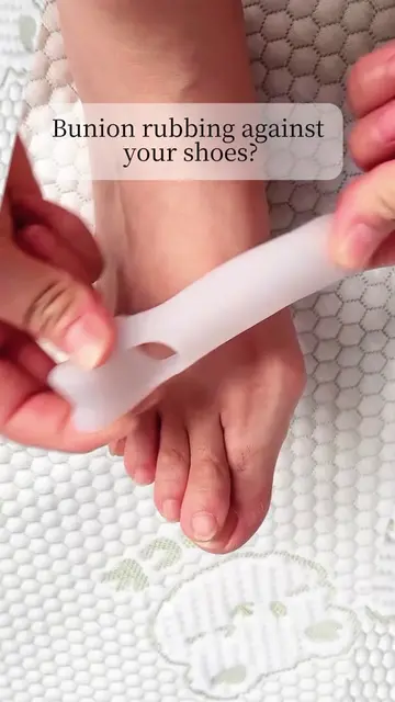 Bunions do not always hurt because of the bump itself—the constant rubbing insid