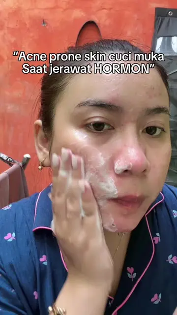 Jangan tanya rasanya😭 #acnetreatment #acneproneskin #jerawathormon #bagibagi 