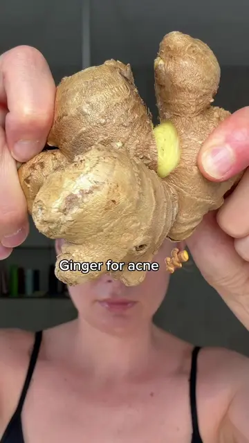 ginger for acne🫚 #creatorsearchinsights #skin #skincare 