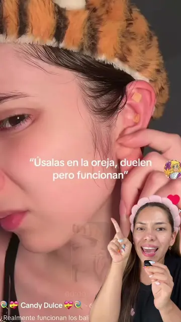 Ear seeds o balines como usarlos 👂 #earseeds #acupuntura #wellness #hacksdebell