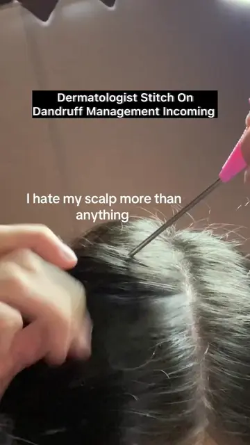 Flakes raining down from your scalp all day long? ❄️ Shampooing less may actuall
