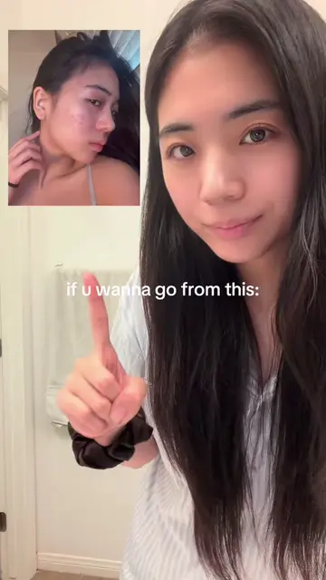 🌙detailed nighttime tretinoin skincare routine for acne-prone skin!! MORNING RO
