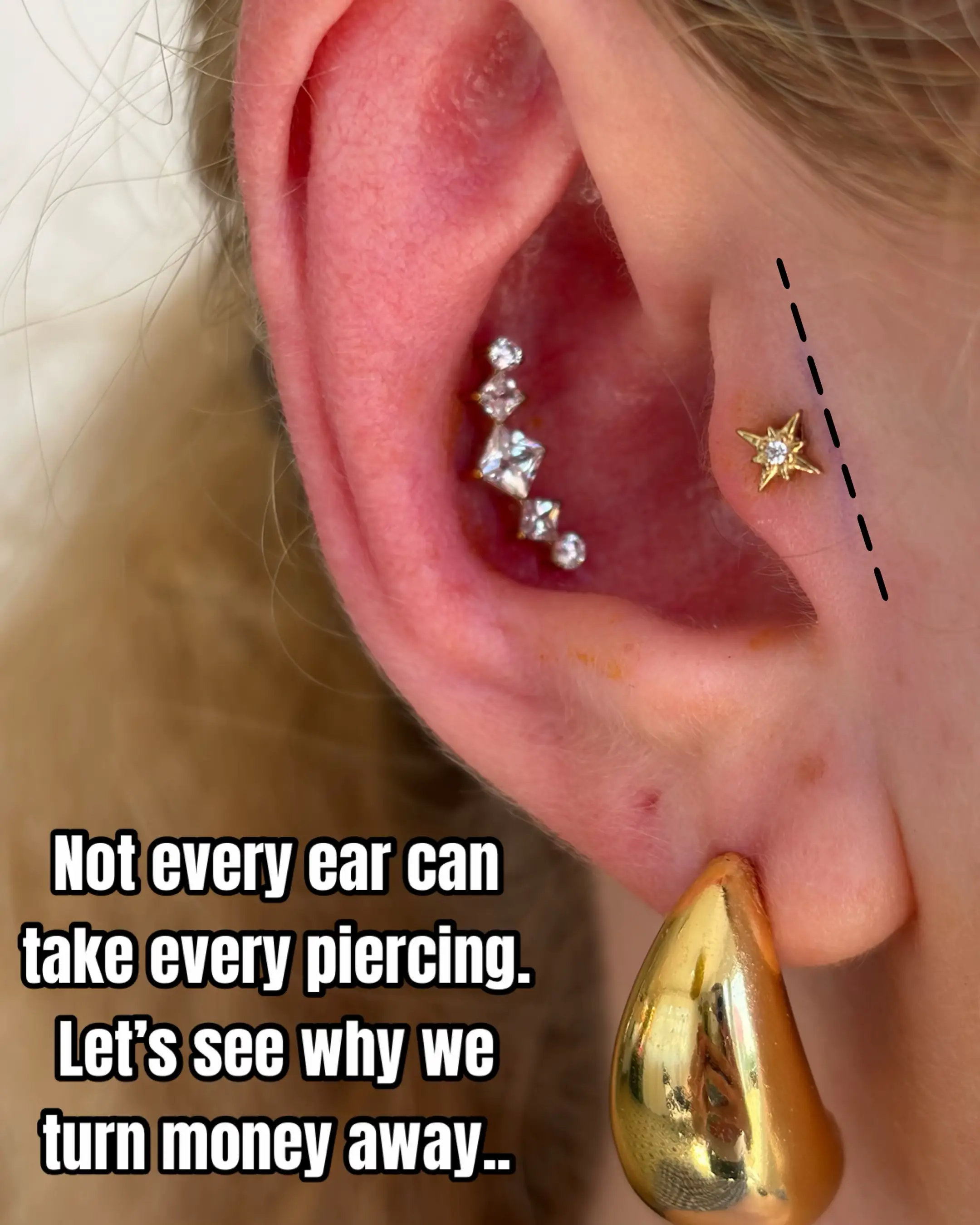 Not every ear can take every piercing BUT why? The end result will be a disastro
