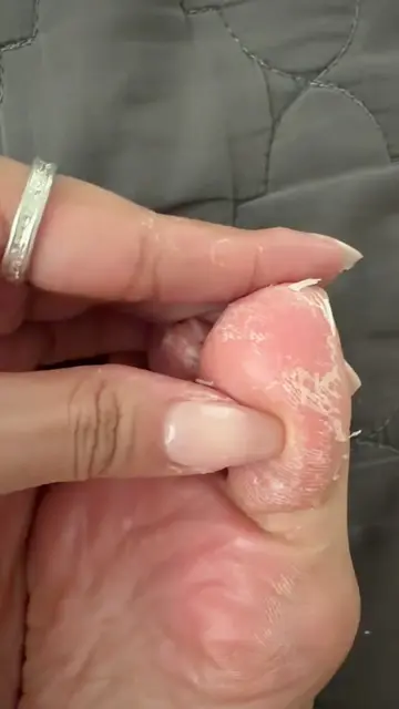 Never had this severe eczema in life Product used : Cosrx blue peptide serum & c
