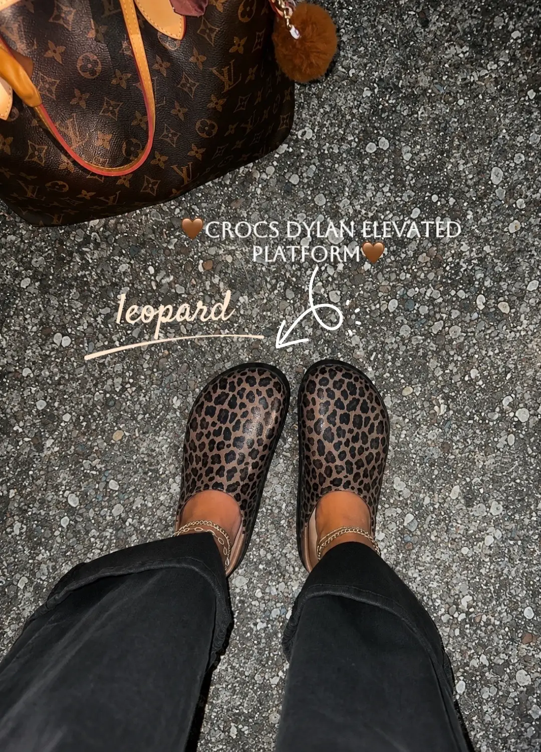 Leopard is the neutral of the season, and these platform clogs are proof. 🤎🐆 T