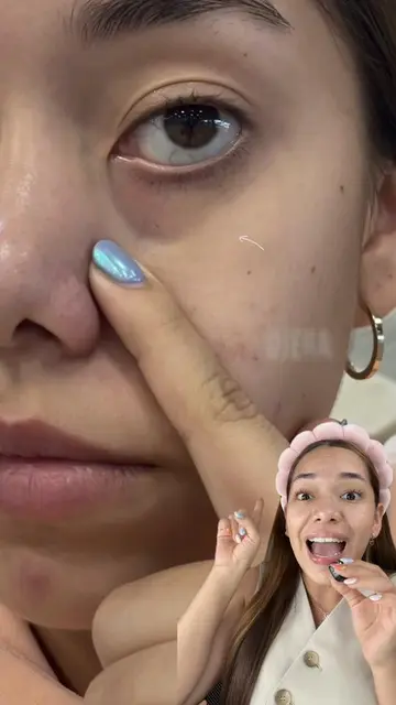 Como disminuir ojeras 👁️ @numbuzin  Esta con 38% de descuento en YesStyle 🫶🏻 