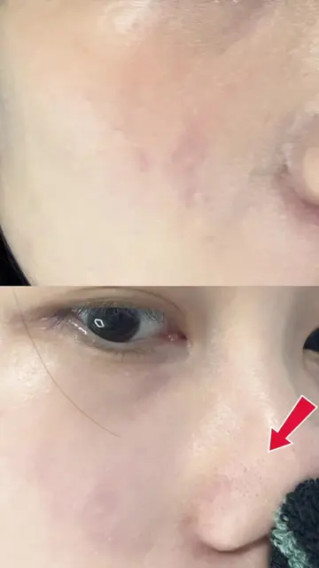 Scrub + cleanser in one wash✅ Remove makeup and gently exfoliate at the same tim