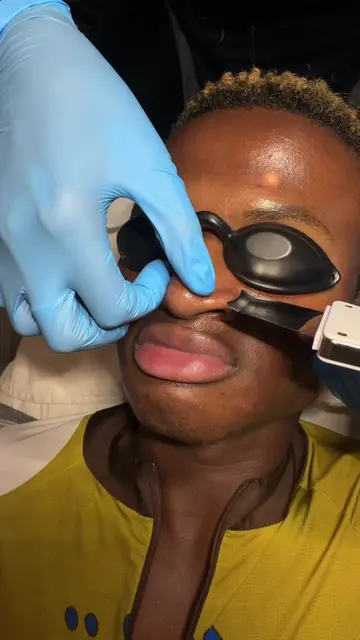 Getting A peel for the first time!! 🤧