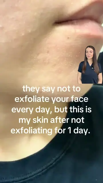 Those tiny dots on your nose aren't always blackheads. More often than not, they
