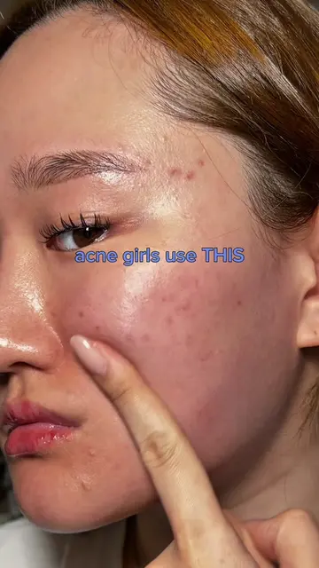 Korean EGF serum to repair red marks💙 @dear, Klairs #klairsegfserum #klairs #ko