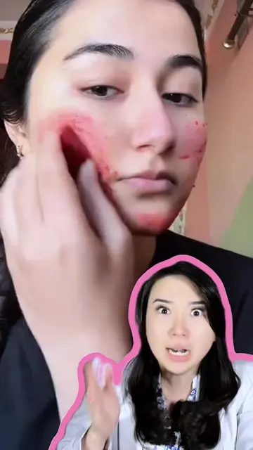 Masih ada aja mitos jerawat yang dipercaya sampai sekarang 😭 Kalau mau jerawat 