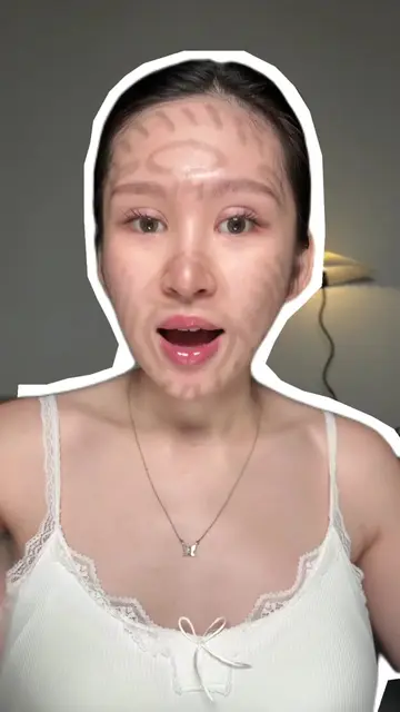 Penyebab jerawat bedasarkan letaknya di wajah & cara sembuhinnya ⬅️✨ ini lumayan