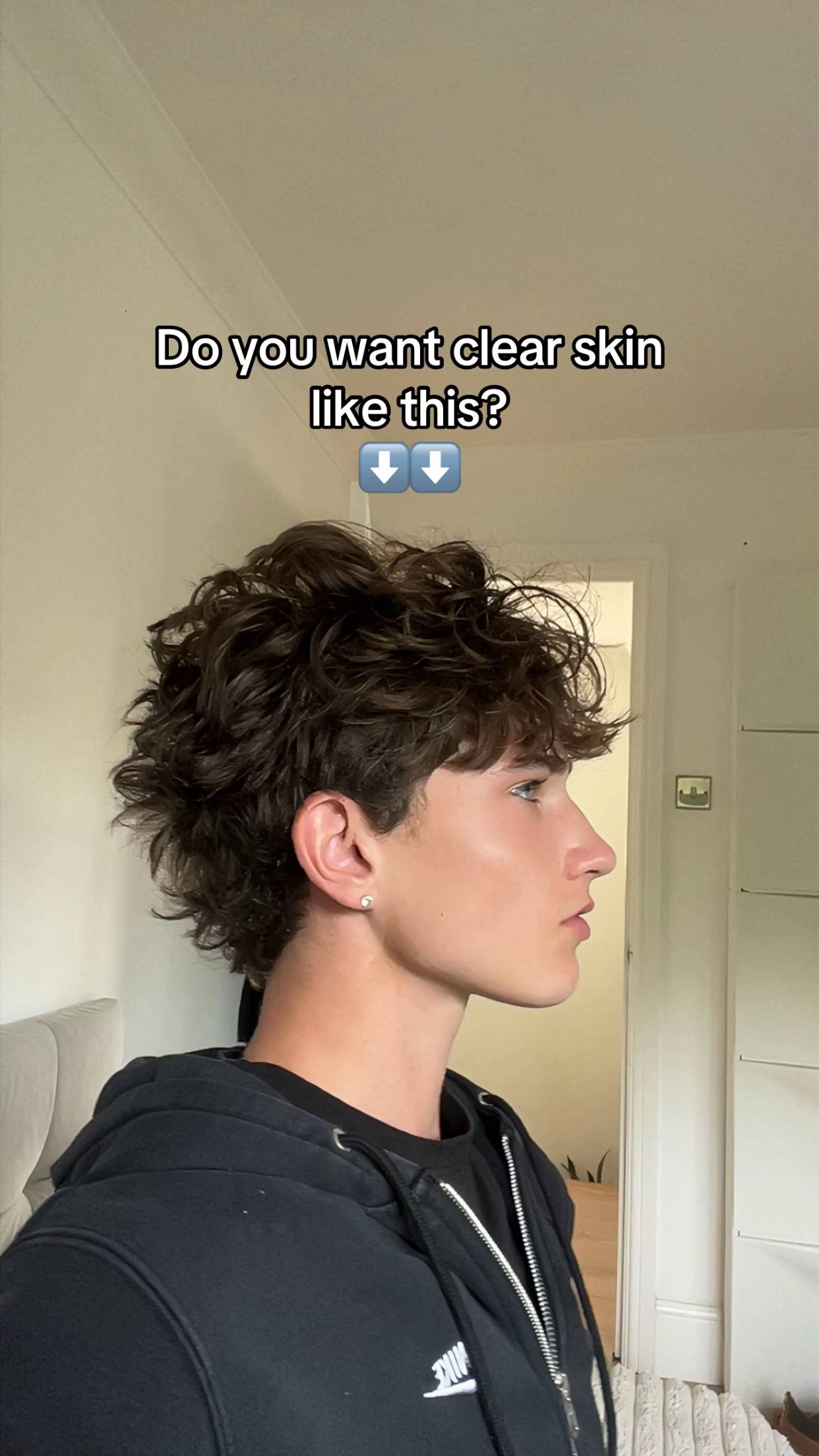 #SelfImprovement #acnetips #skincare #creatorsearchinsights #viral 