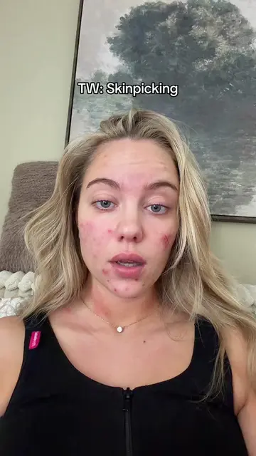 #skinpicking 