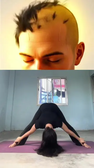 Want healthier hair naturally? 🌱✨ Try these 6 yoga poses to improve scalp blood