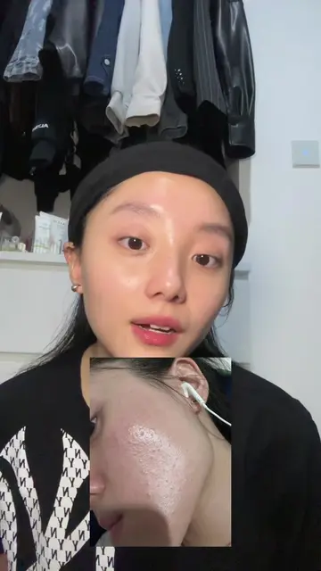 Struggling with close comedones? 👀 Kalau pori-pori kamu gampang clogged, mungki