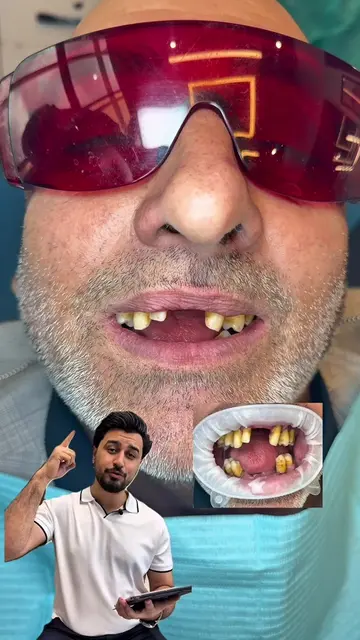 A journey of Perfect Smile Rehabilitation by Dr Haroon Shah 🦷🇵🇰🇬🇧 | complet