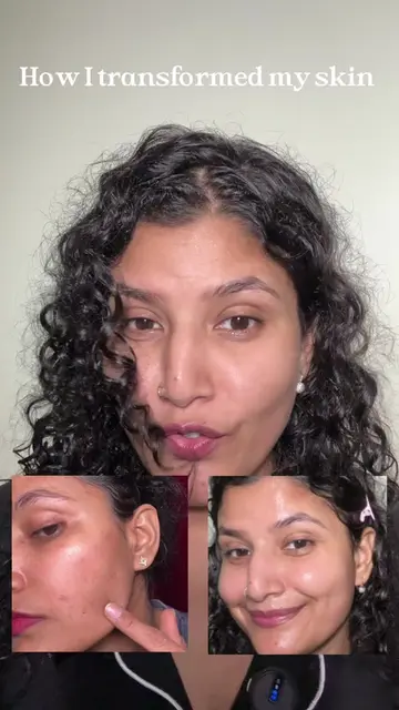 My night time akincare routine as acne prone girl  @medicube US Store Succinic t