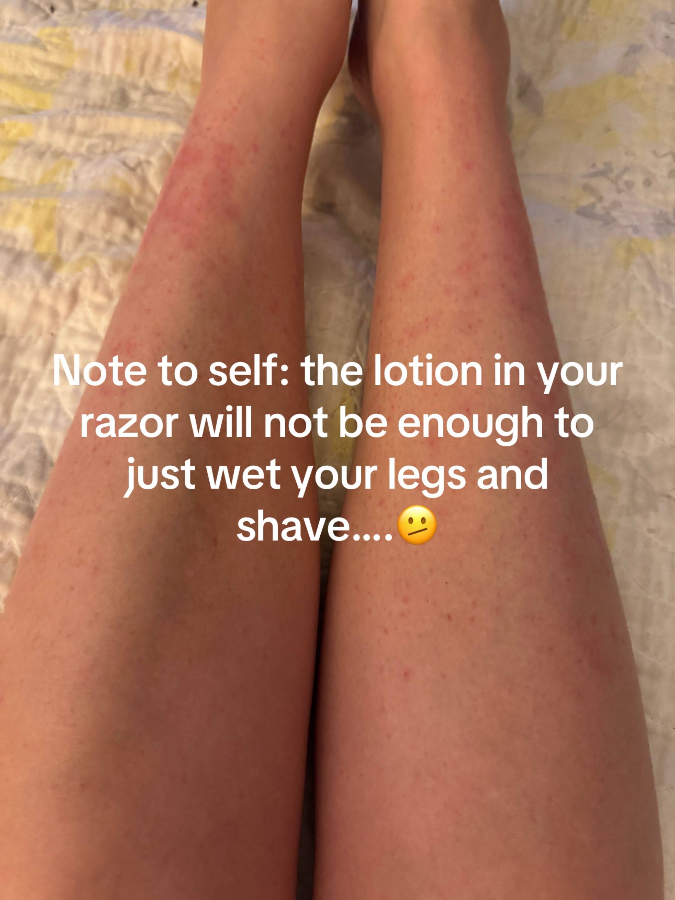 After 46 years, you’d think I know better!! 🫤 #razorburn #shaving #lifelessons 