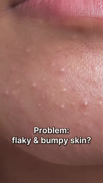 Say goodbye to flaky, bumpy skin 👋 Add Rice Scrub Foam to your routine and let 