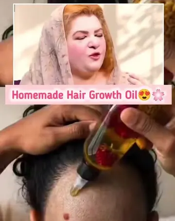 Homemade Hair Growth Oil 🌸 #HairGrowthOil #HairFallControl #HairCare #HairGrowt