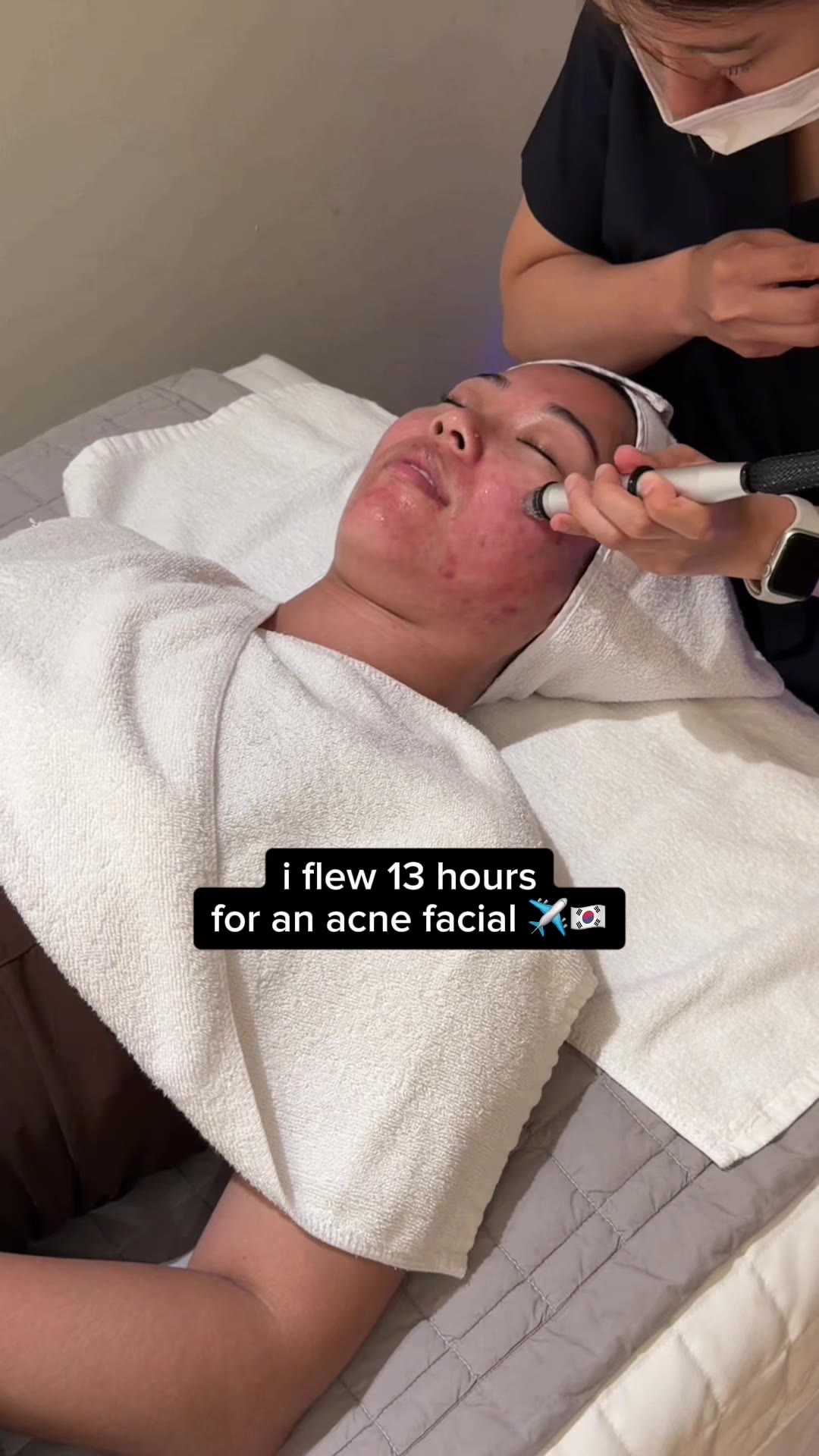 im so jealous at how accessible skin clinics are in korea 🤧 #acnefacial #acne #