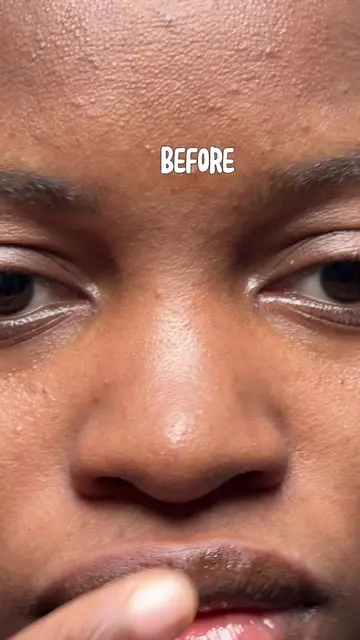 No more strawberry nose 🍓👃@manyo #manyo #cleansingoil #blackhead #porecare #Cl
