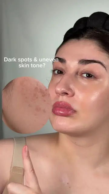 Dark spots? We’re working on it ✨ @APOTHE  The APOTHE Exosome Mela-Glu Dark Spot