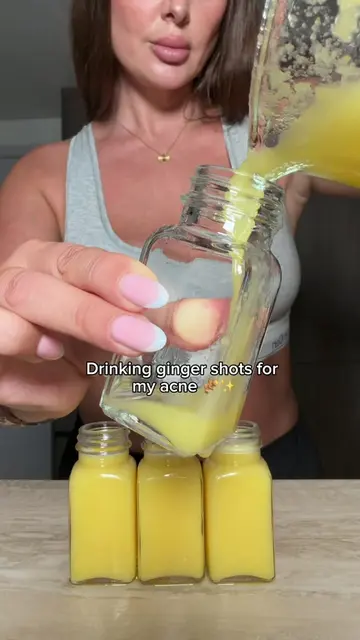 Ginger shots may help improve acne thanks to their anti-inflammatory properties 
